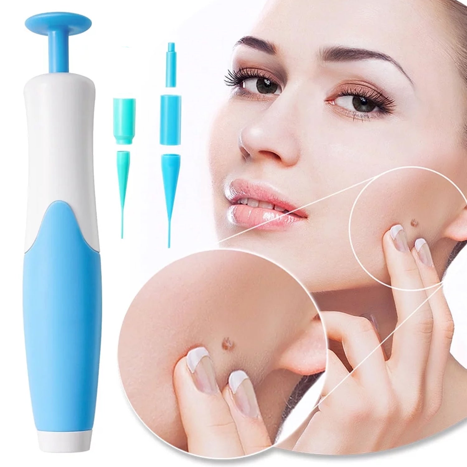 Skin Tag Remover Kit 2 In 1 For Micro To Large (2 Mm - 8 Mm 1 Set)