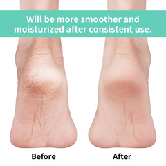 Anti Crack Silicon Gel Heel Moisturizing Socks for Foot Care Men Women (Loose Pack)